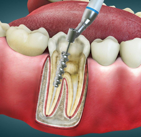 Orthodontist in ooty